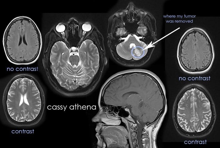 Cassy Athena brain scan